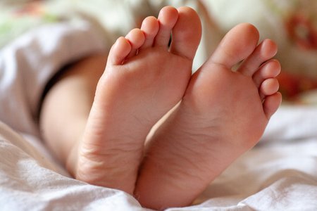 121526651-young-girls-toes-are-healthy-and-beautiful-well-groomed-toes-concept-for-medical-articles-and